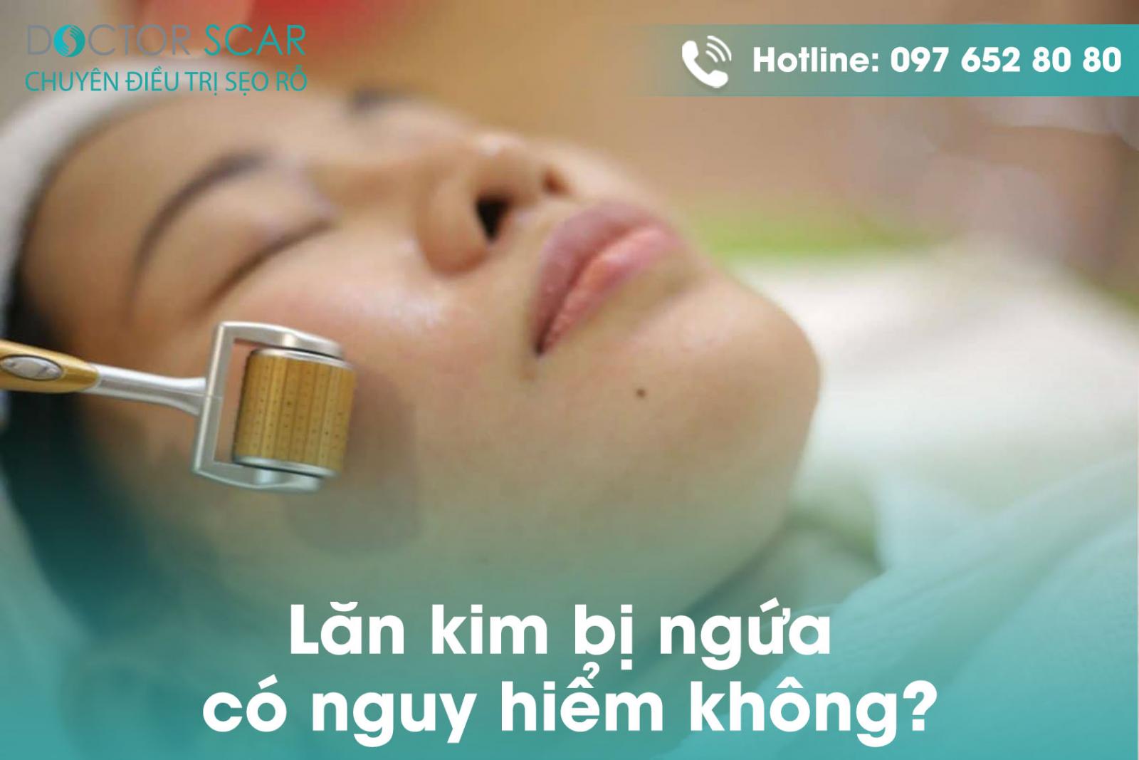 Lăn kim bị ngứa có nguy hiểm không?