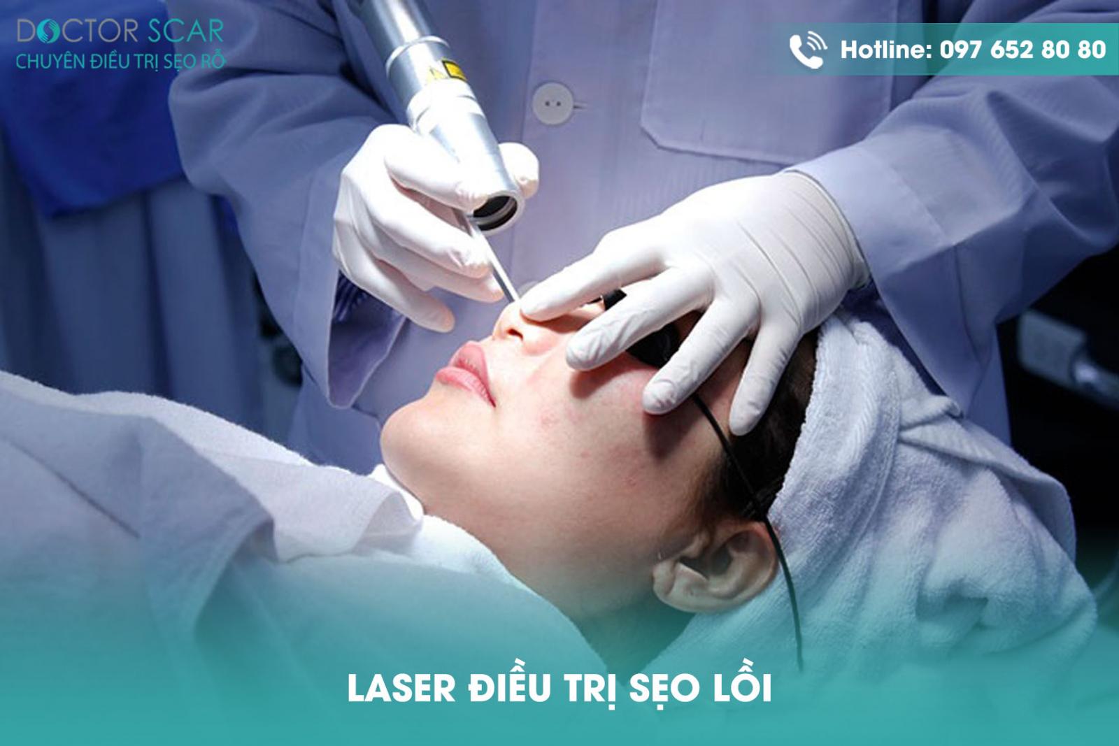 Laser điều trị sẹo lồi