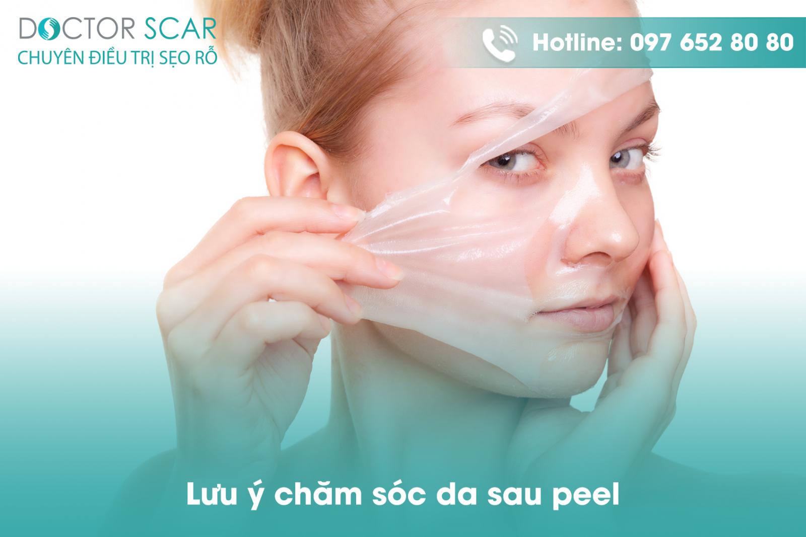 Lưu ý chăm sóc da sau peel