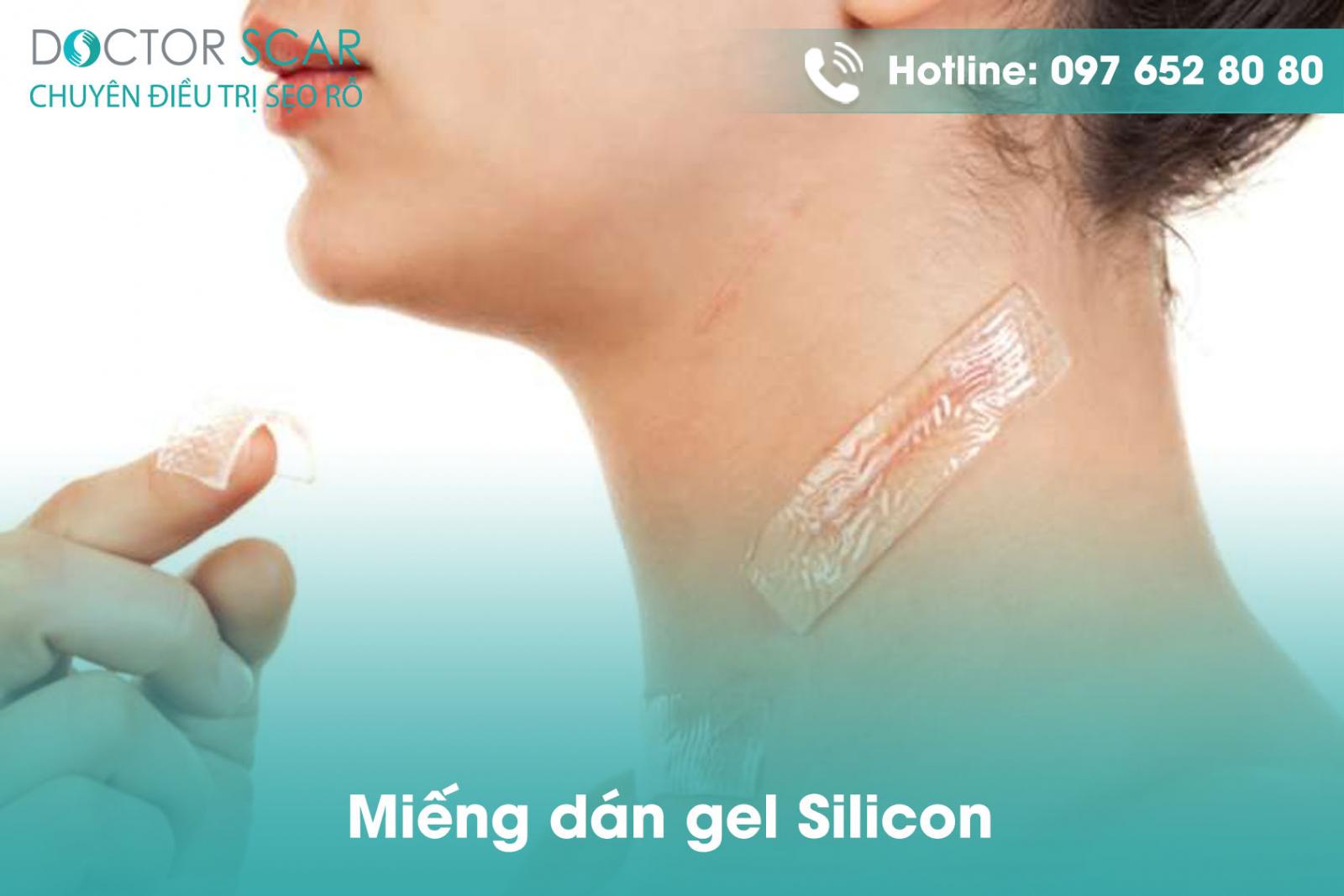 Miếng dán gel Silicon trị sẹo lồi.