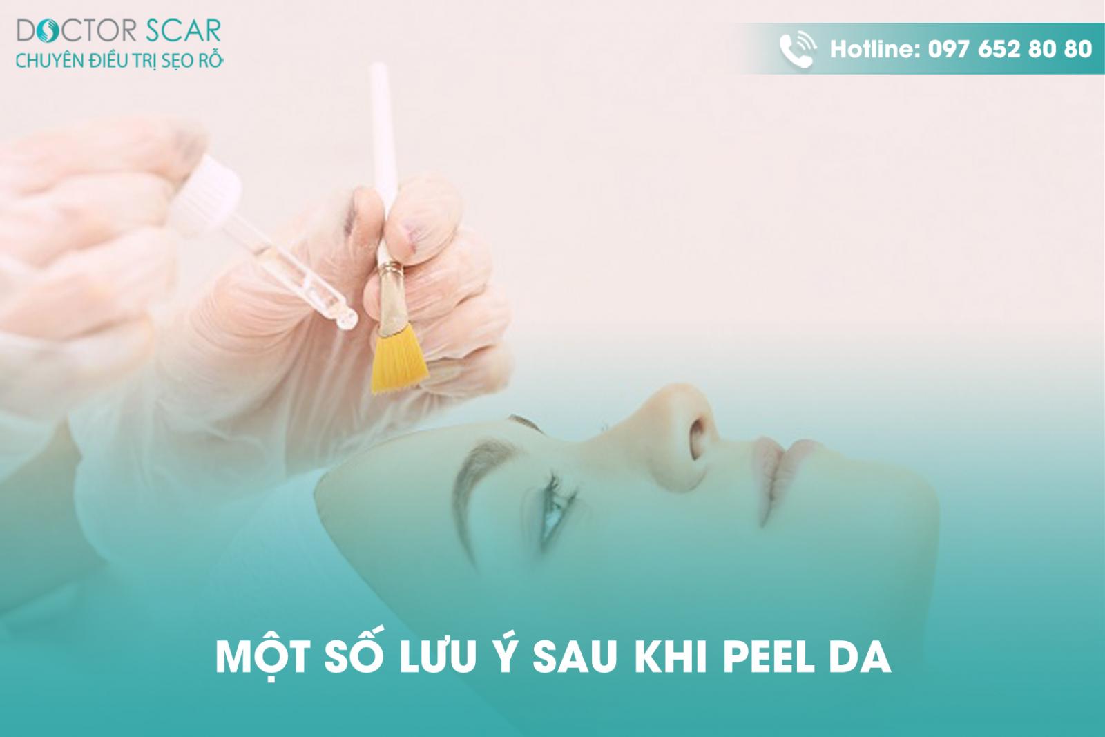 Một số điều cần lưu ý sau đây