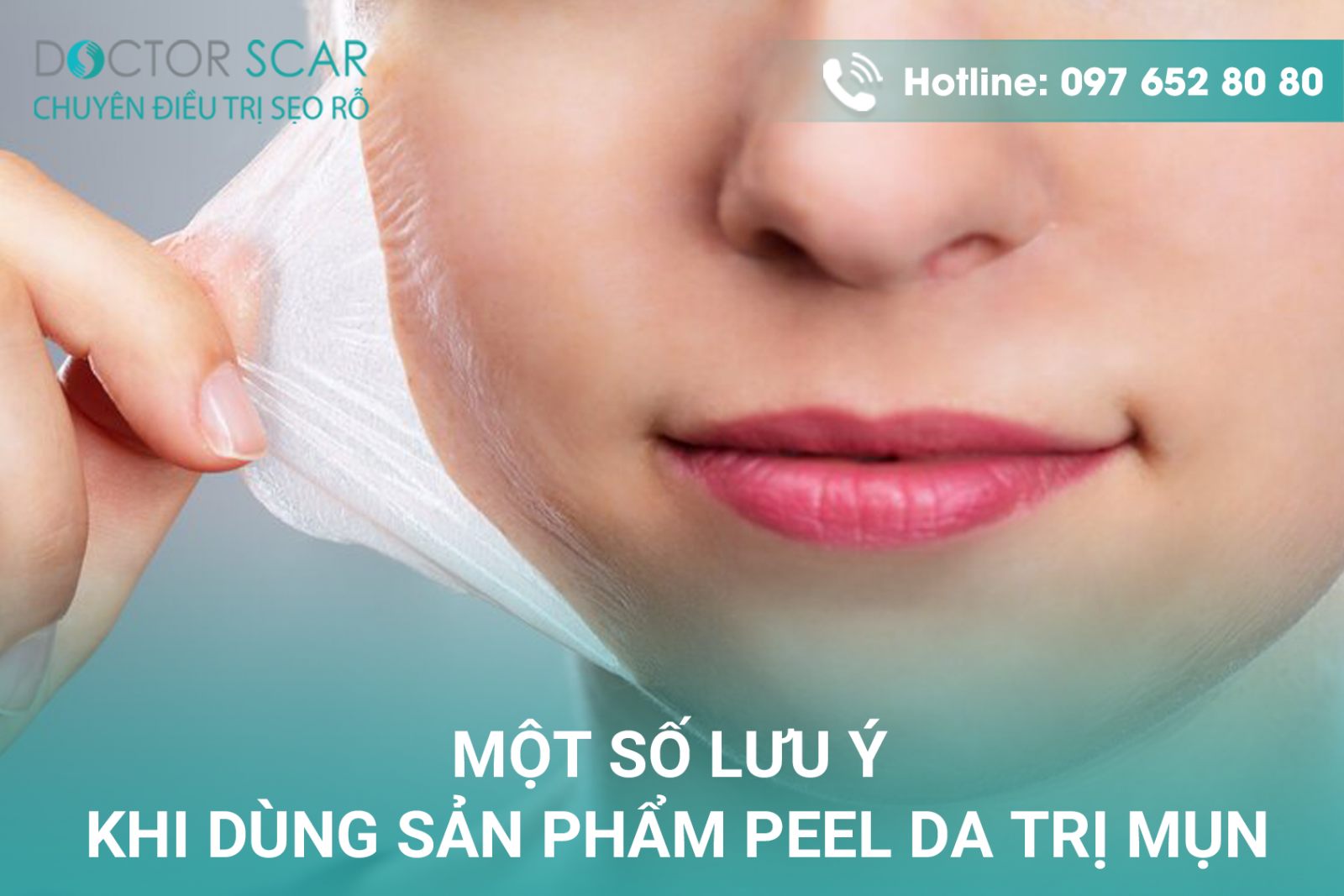 Một vài lưu ý khi thực hiện peel da.