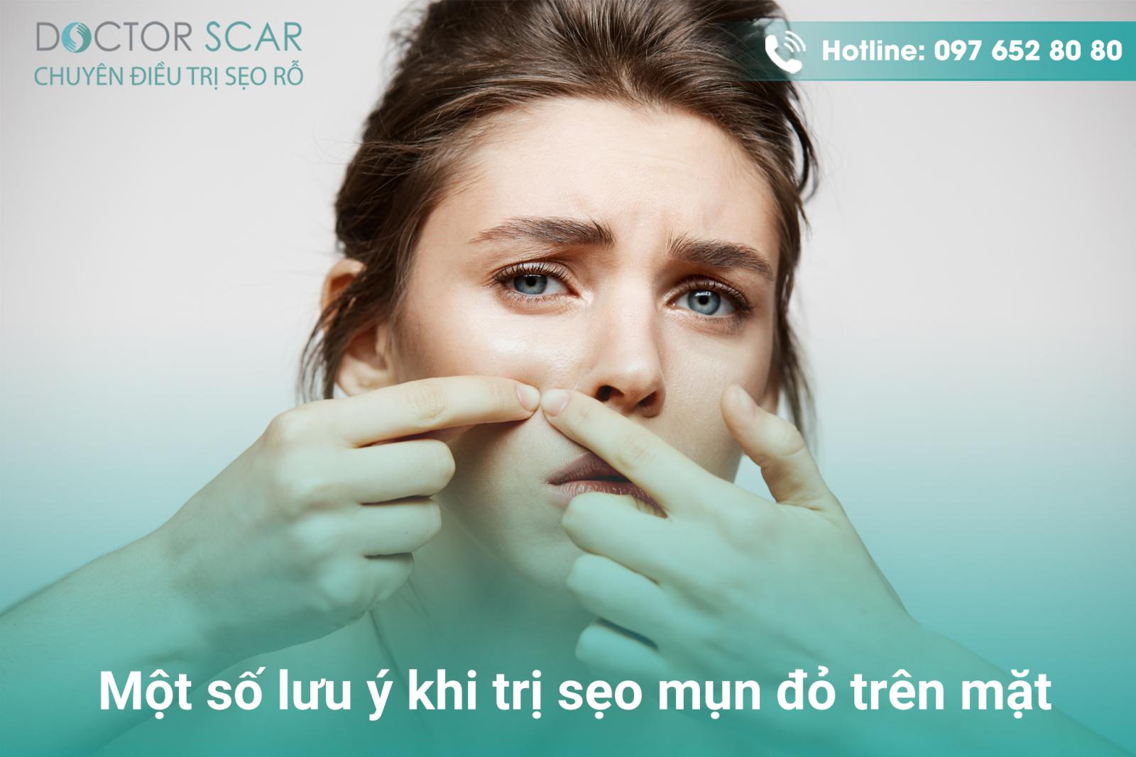 Một số lưu ý khi trị sẹo mụn đỏ trên mặt.