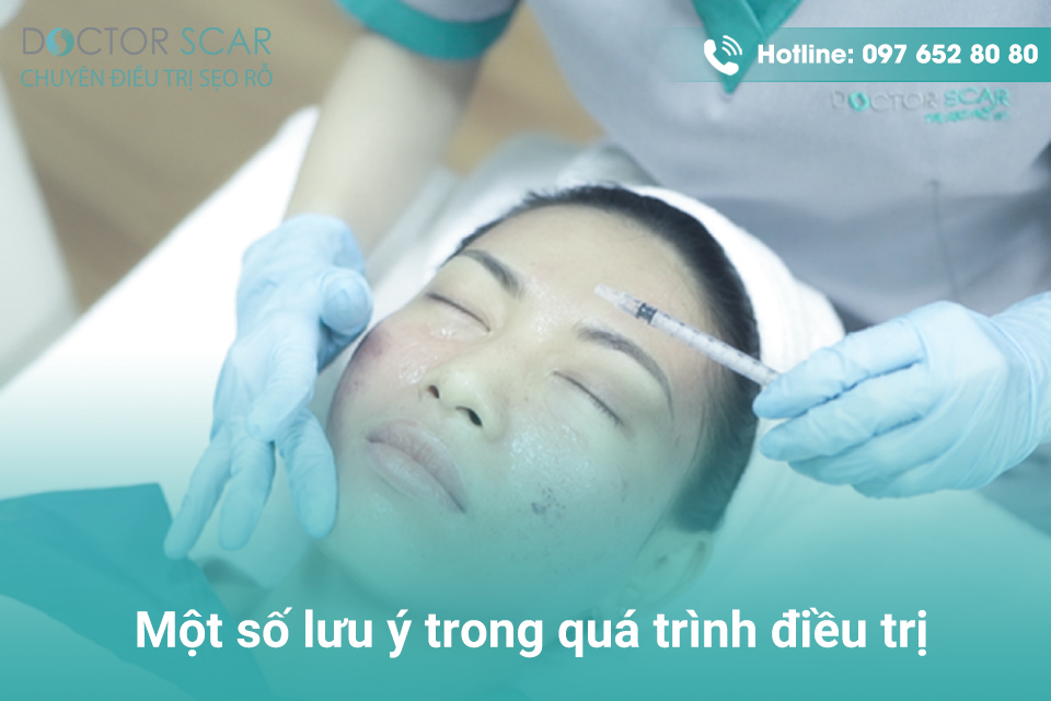 Một số lưu ý trong quá trình điều trị sẹo trắng