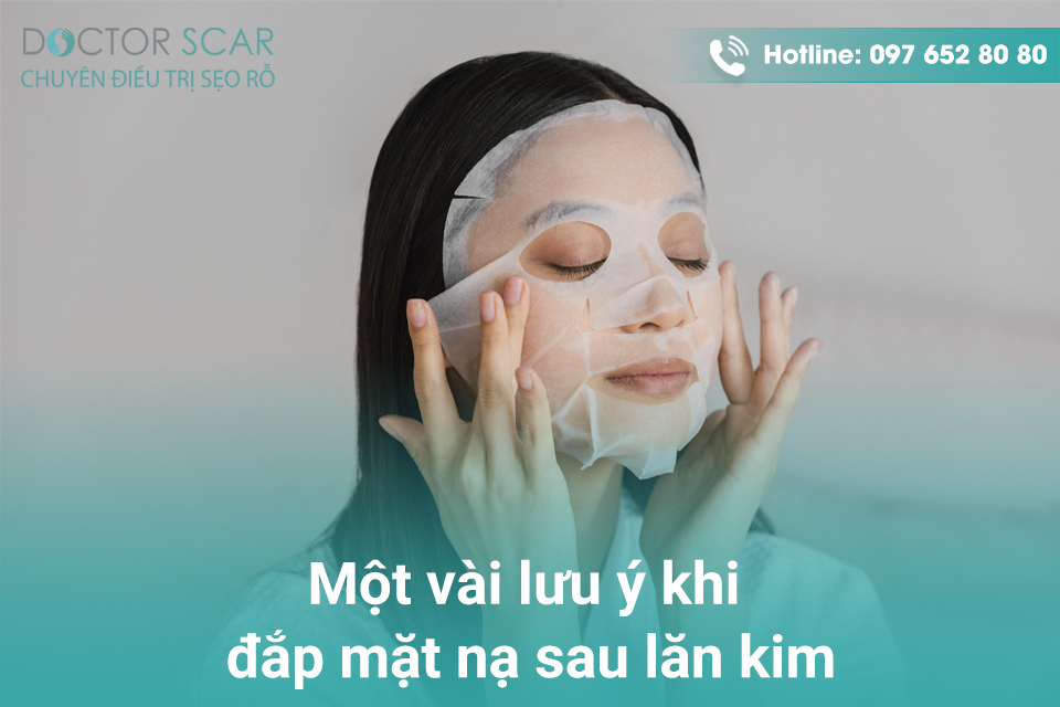 Một vài lưu ý khi đắp mặt nạ sau lăn kim.