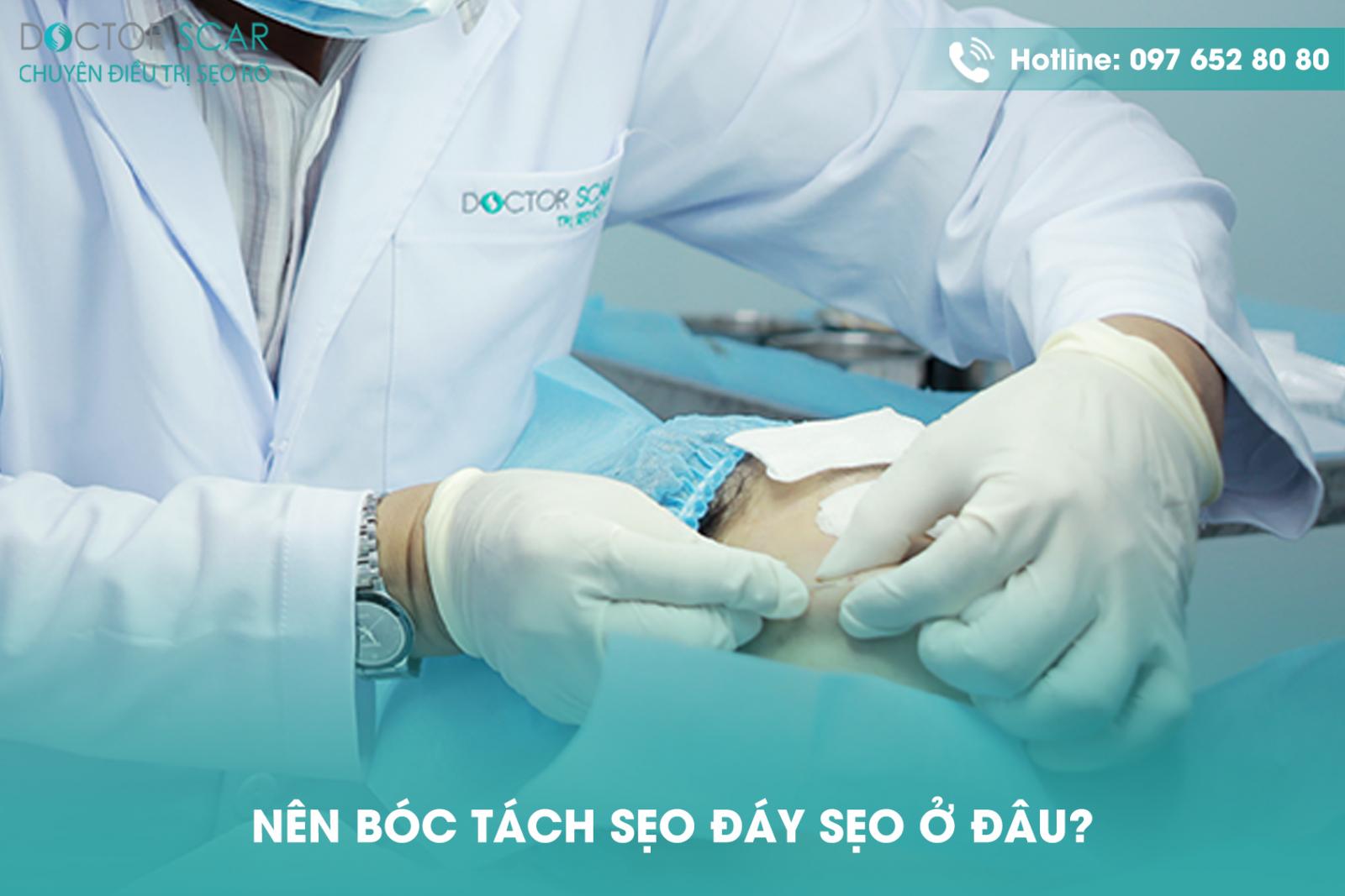 Nên bóc tách đáy sẹo ở đâu?