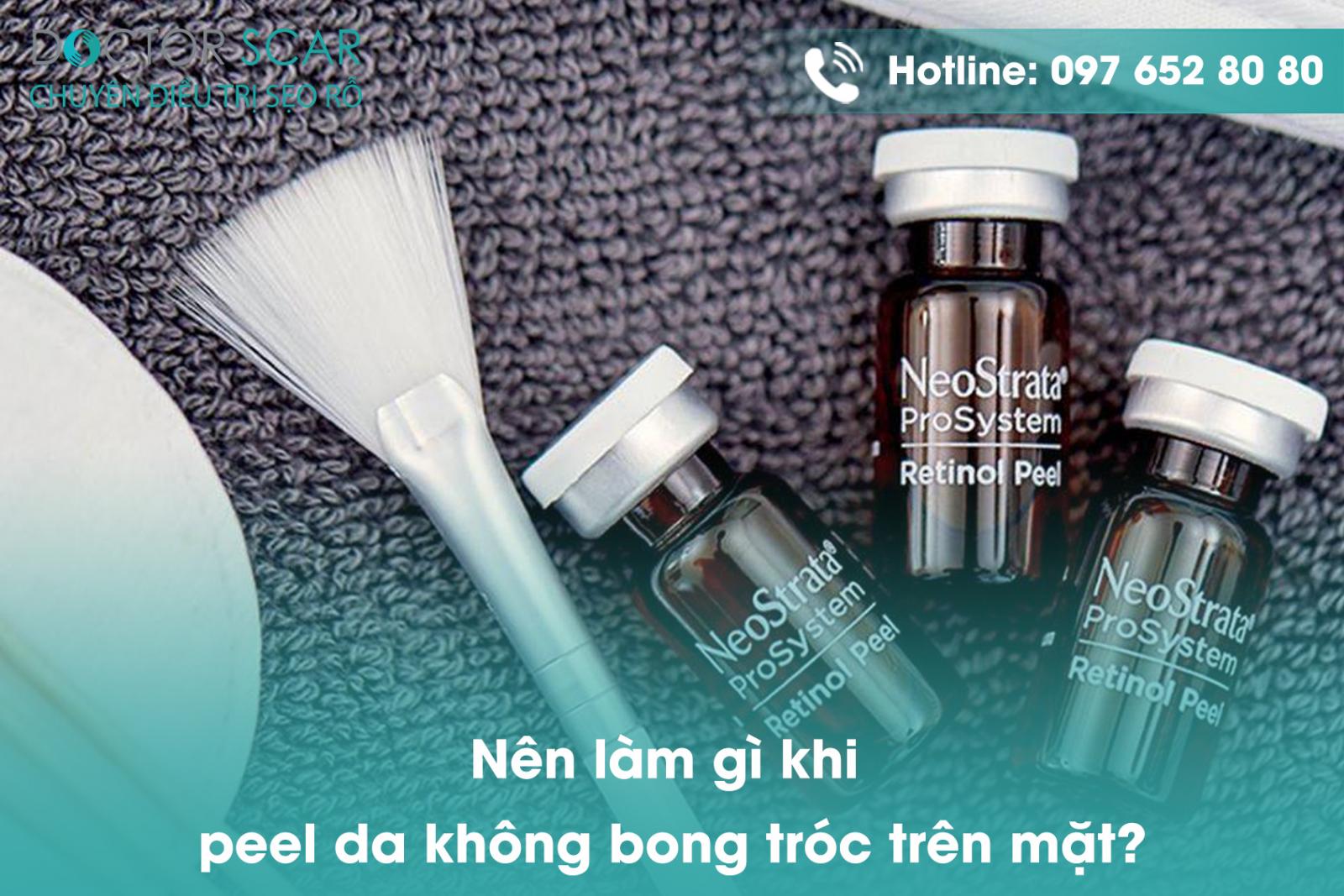 Nên làm gì khi peel da không bong tróc trên mặt?