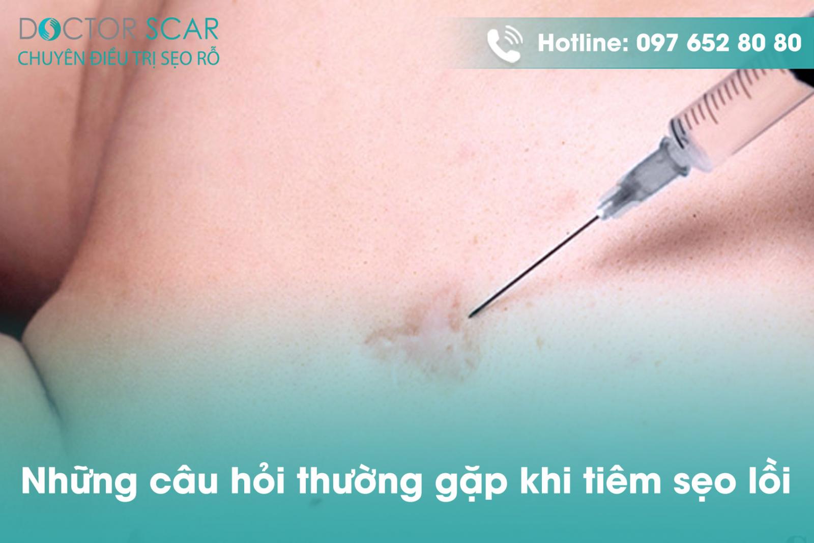 Những câu hỏi thường gặp khi tiêm sẹo lồi