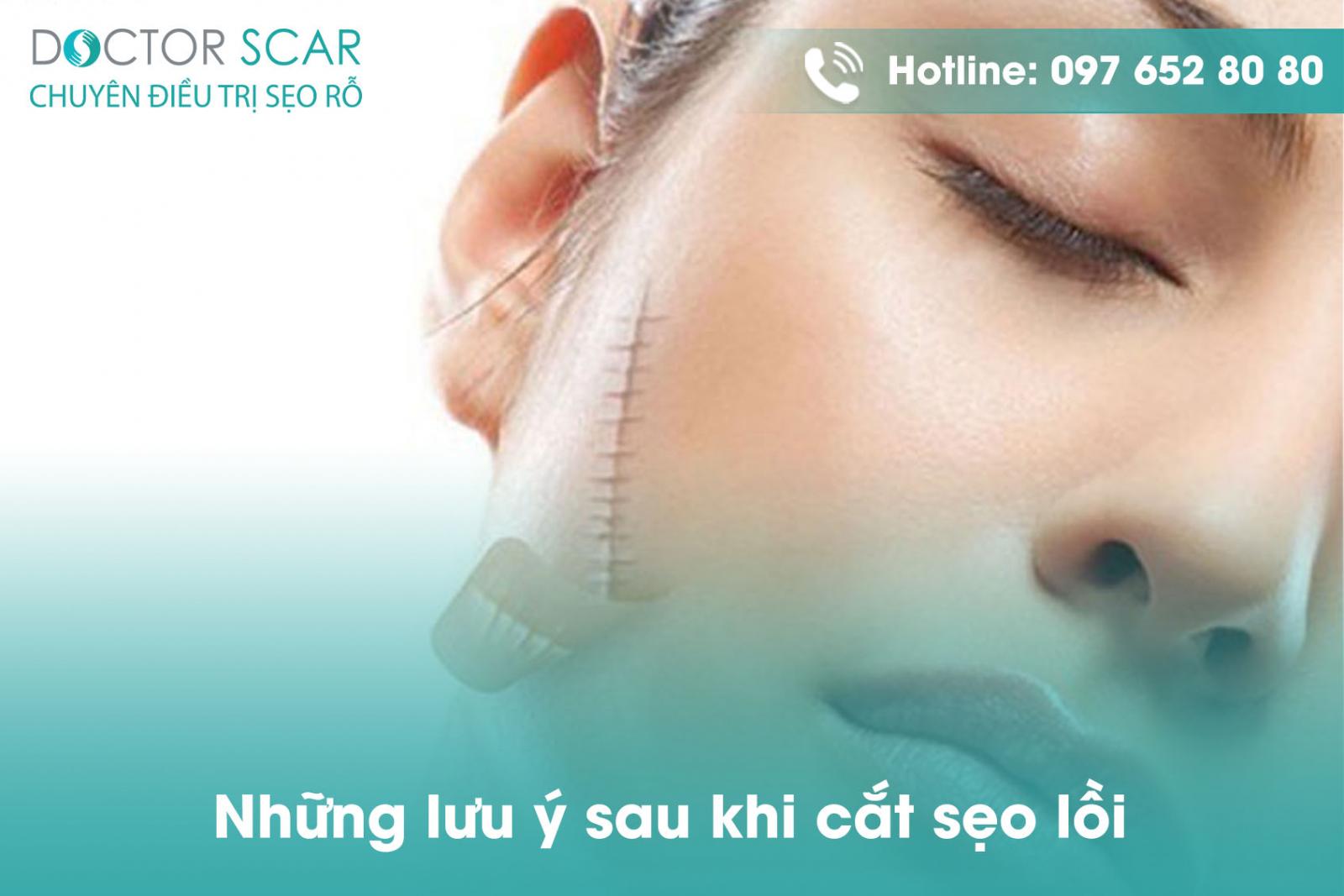 Những lưu ý sau khi cắt sẹo lồi