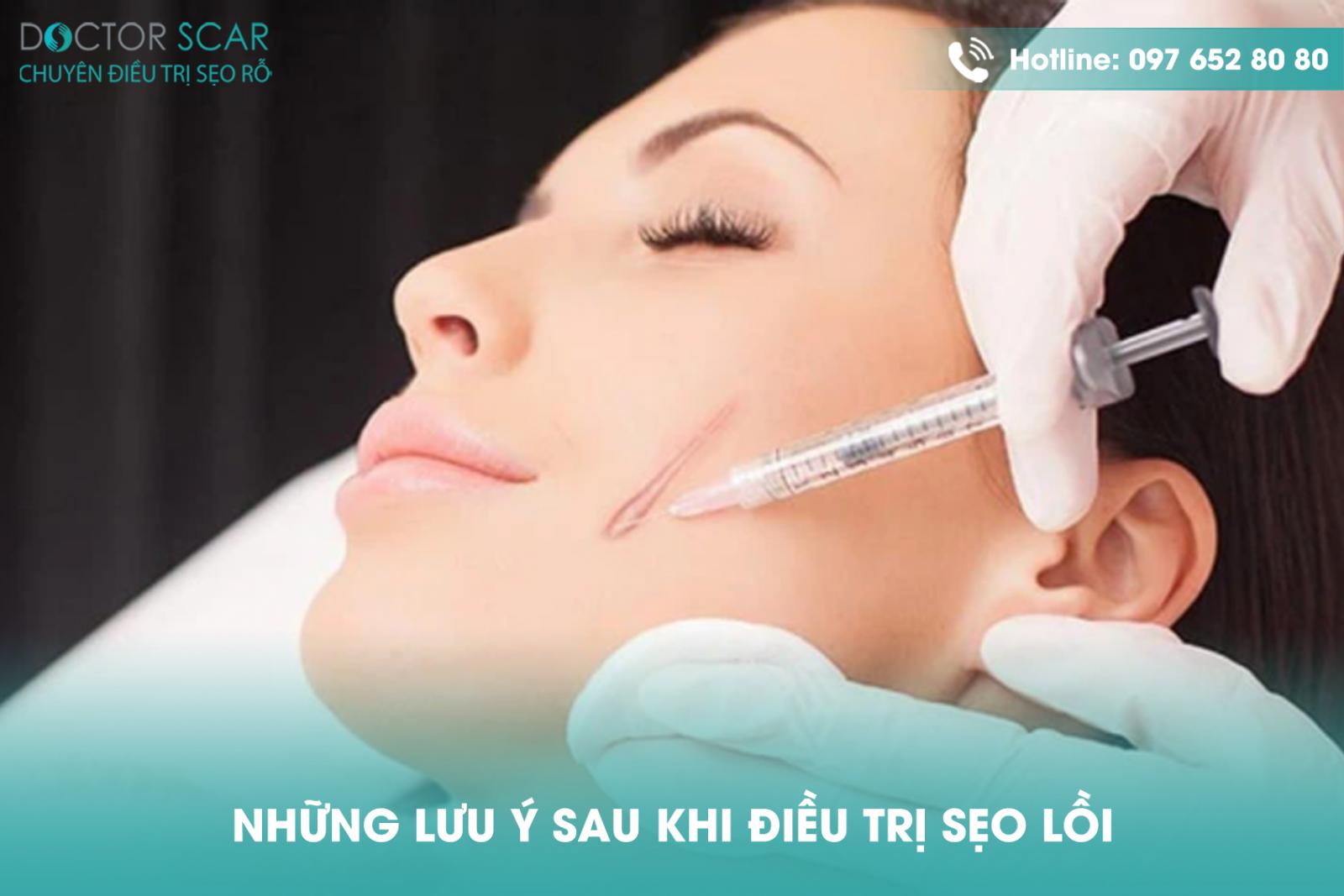 Những lưu ý sau khi điều trị sẹo lồi