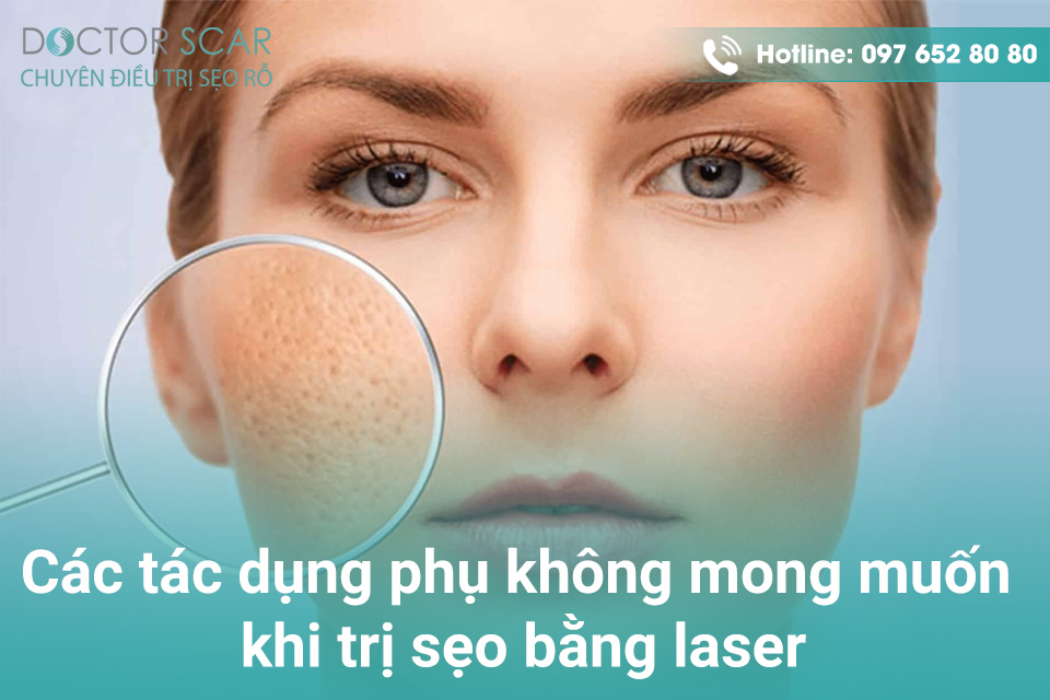 Các tác dụng phụ không mong muốn khi trị sẹo bằng laser