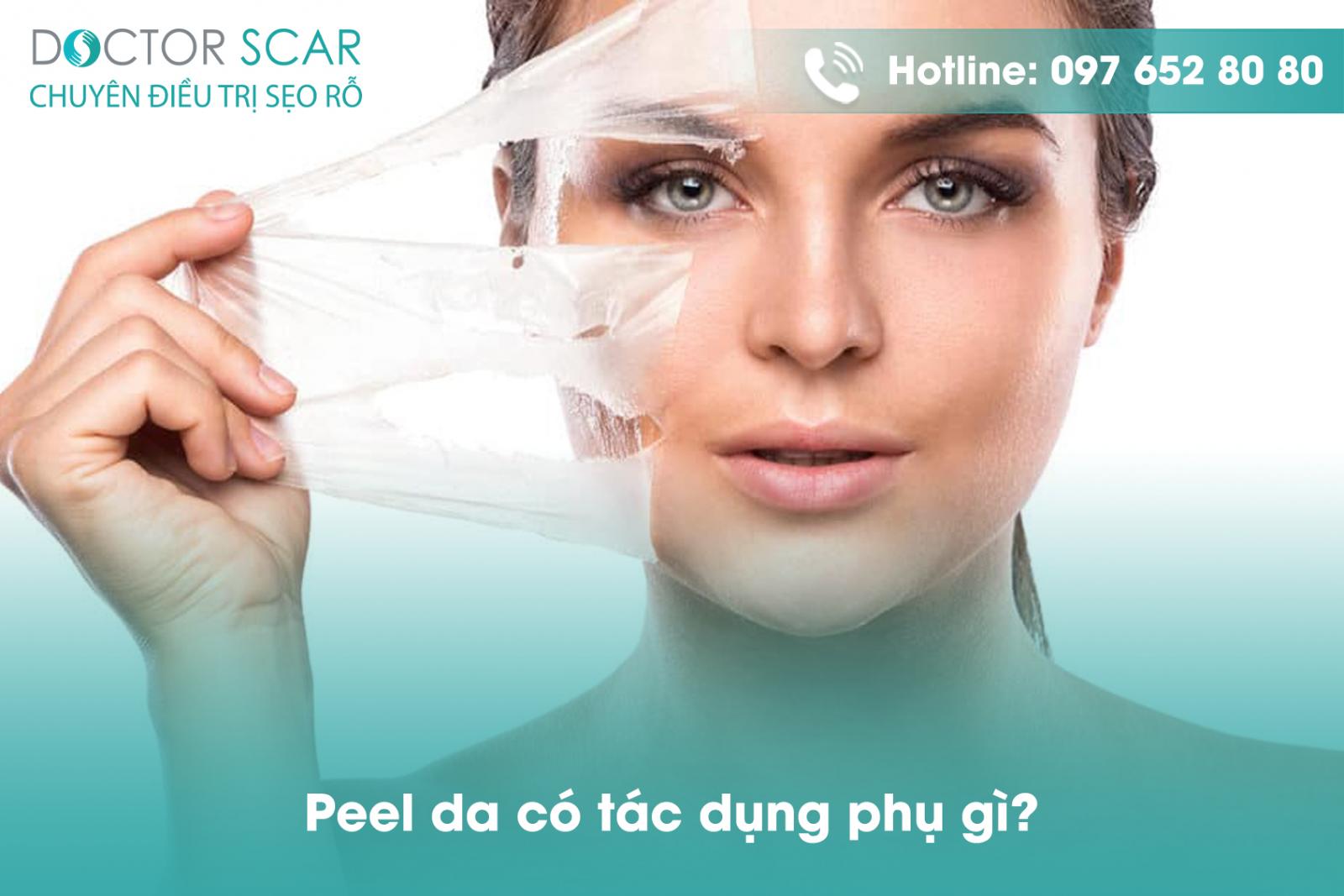 Peel da có tác dụng phụ gì?