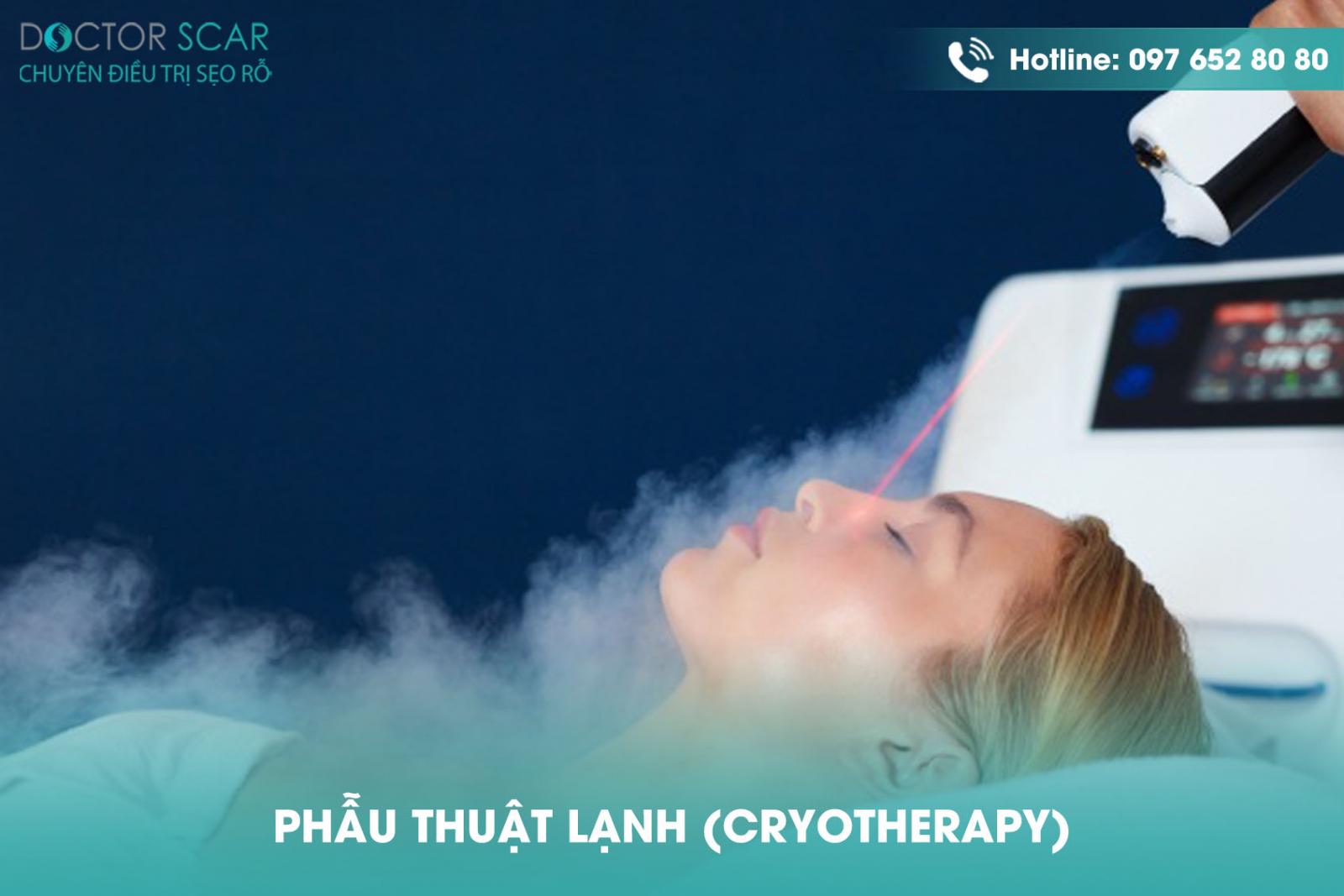 Phẫu thuật lạnh (cryotherapy)