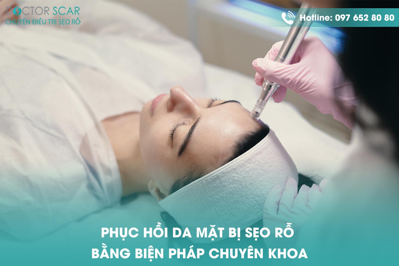 Phục hồi da mặt bị sẹo rỗ bằng biện pháp chuyên khoa