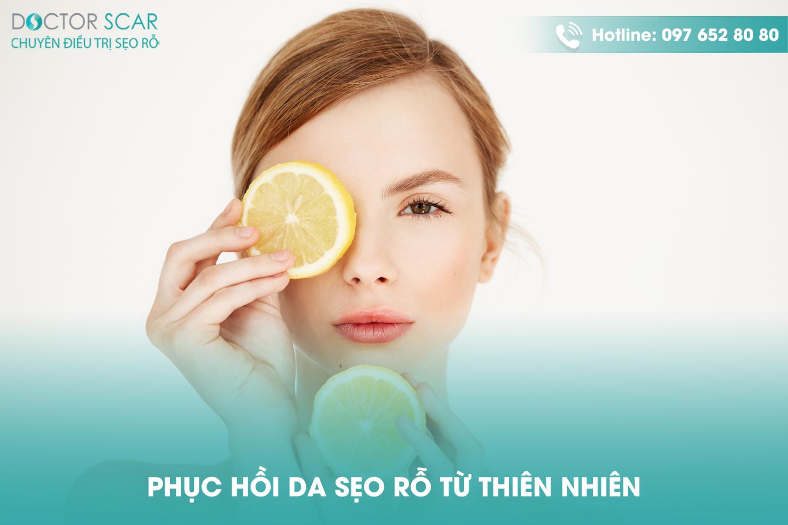 Phục hồi da sẹo rỗ từ thiên nhiên