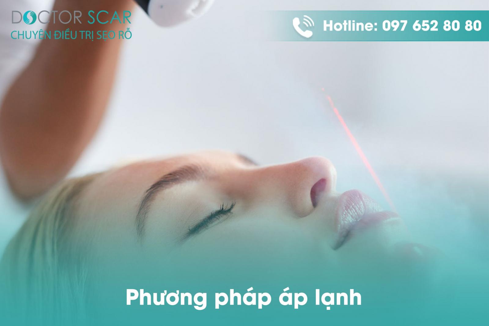 Phương pháp áp lạnh