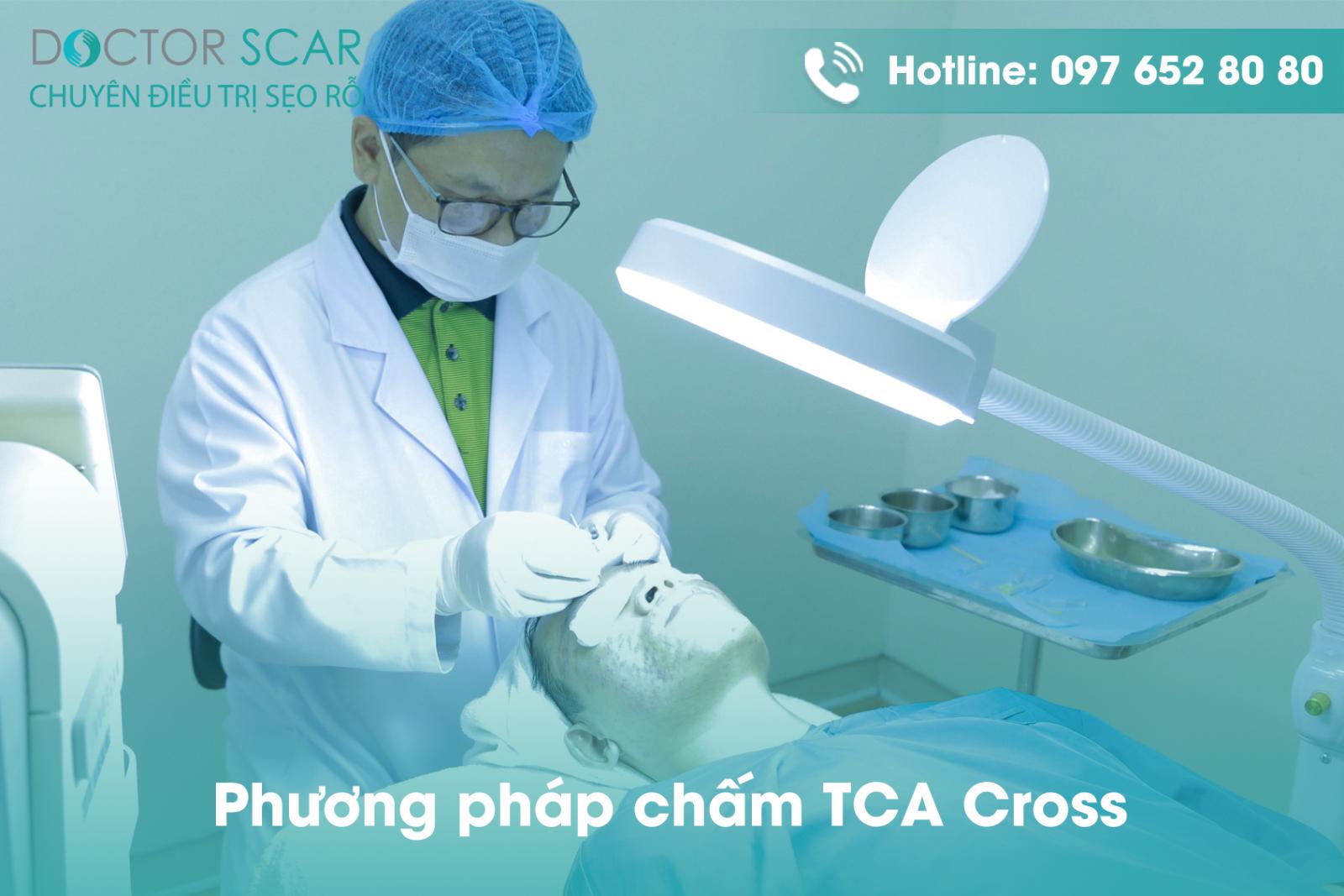 Phương pháp chấm TCA Cross