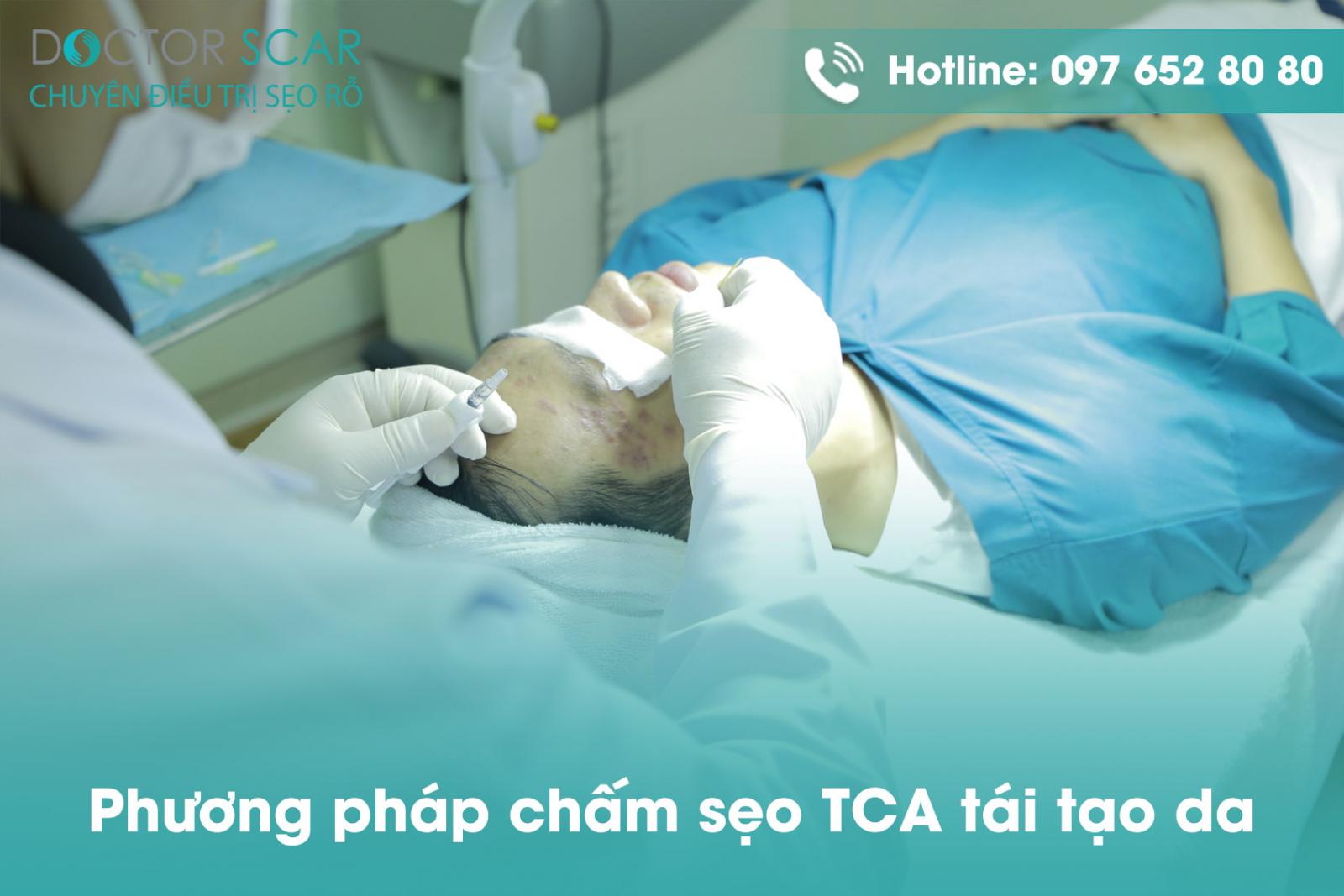 Phương pháp chấm sẹo TCA tái tạo da