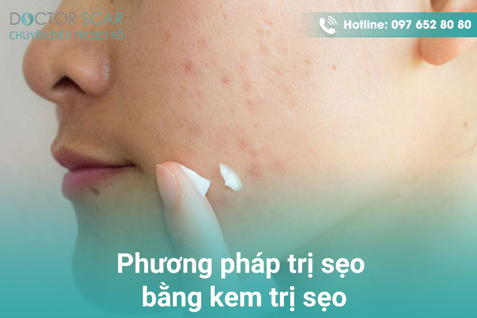 Phương pháp dùng kem trị sẹo.