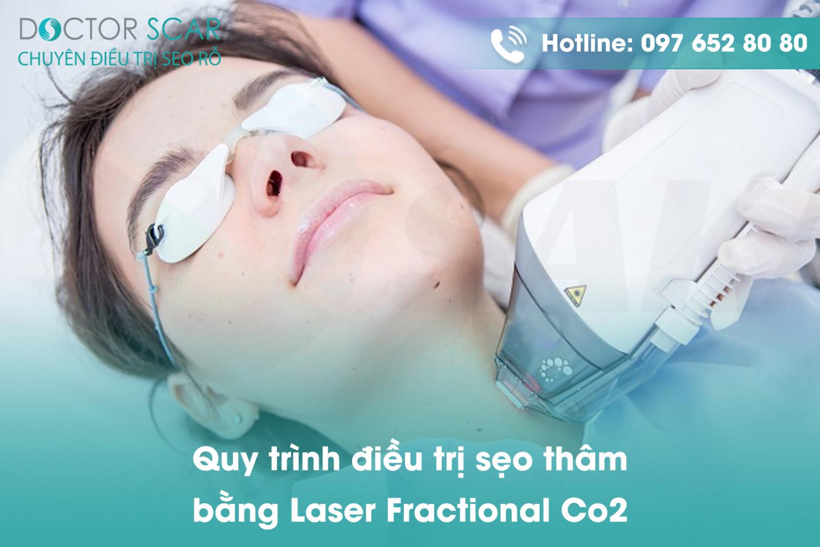 Quy trình điều trị sẹo thâm bằng Laser Fractional CO2.