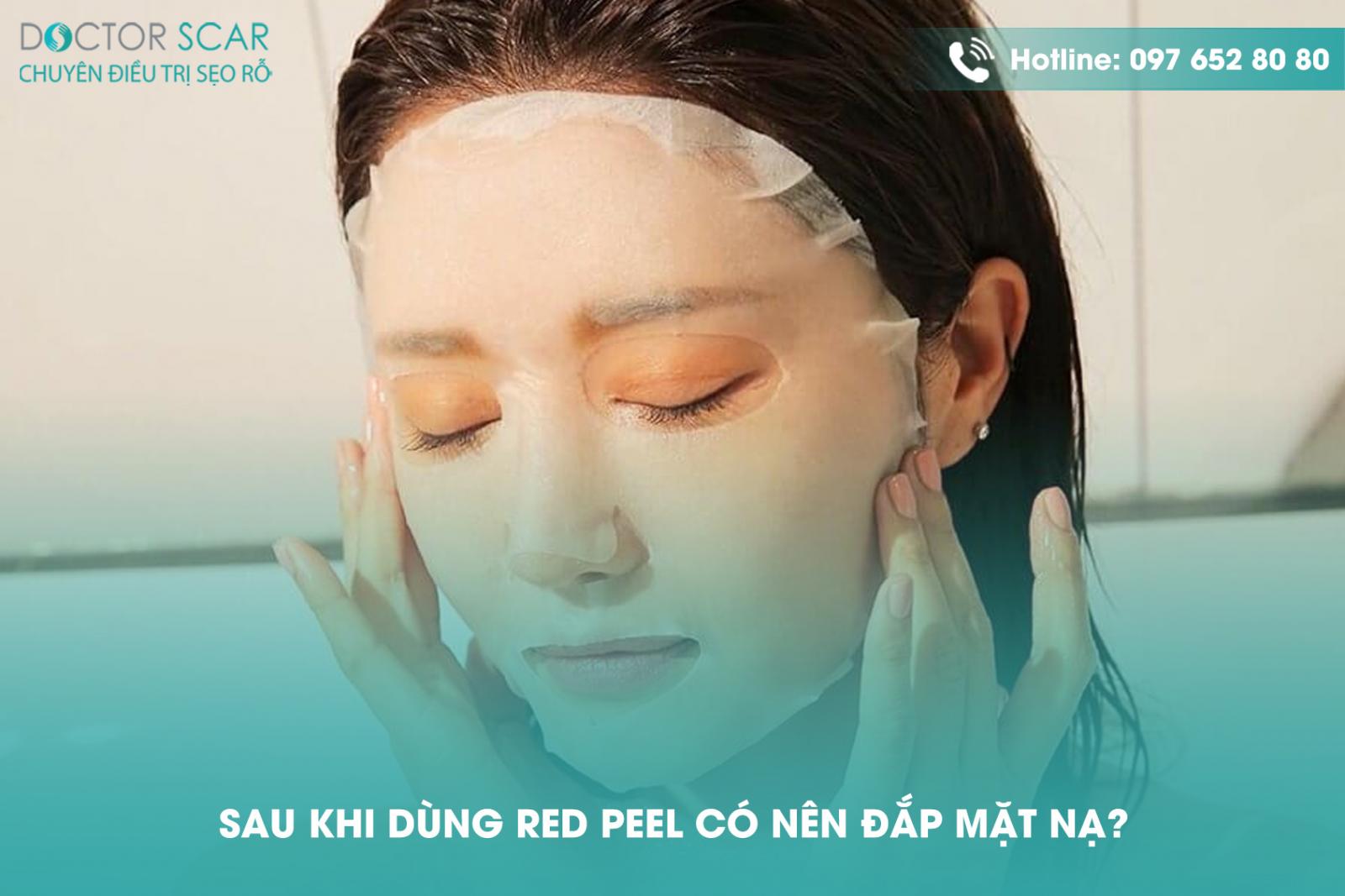 Sau khi dùng red peel có nên đắp mặt nạ?