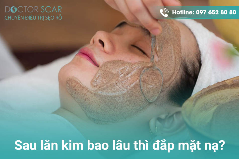 Sau lăn kim bao lâu thì đắp mặt nạ?