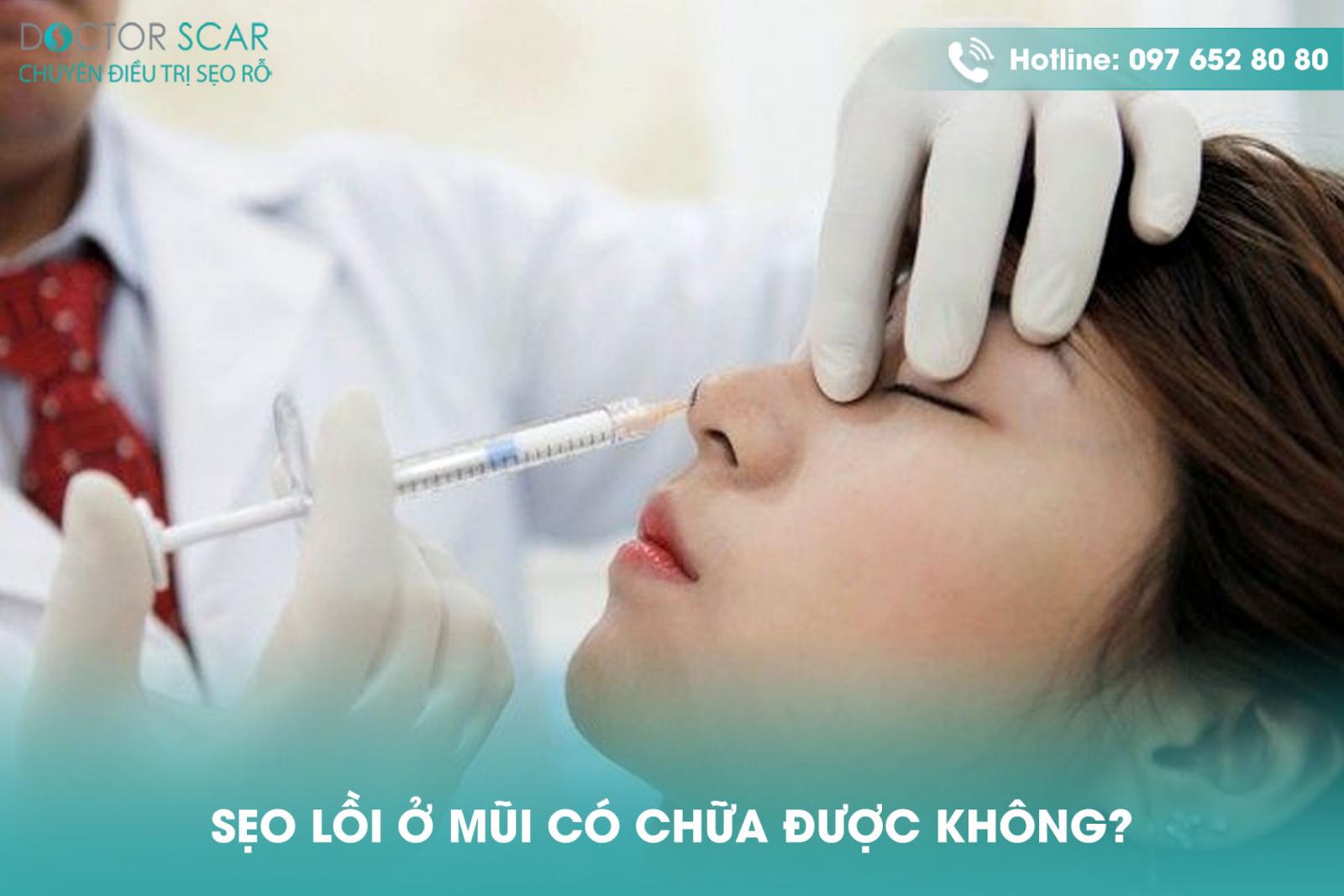 Sẹo lồi ở mũi có chữa được không?