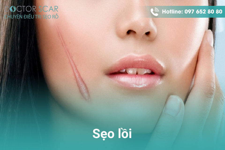 Trị sẹo bằng laser có đau không?