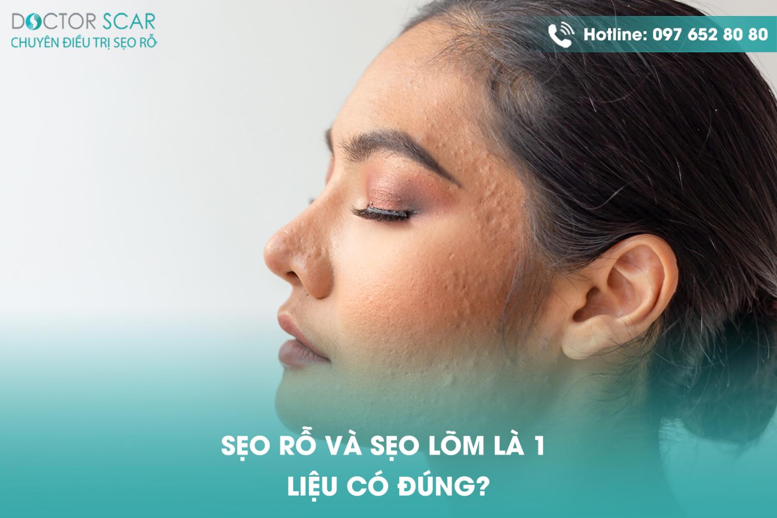 Sẹo rỗ và sẹo lõm là 1 liệu có đúng?