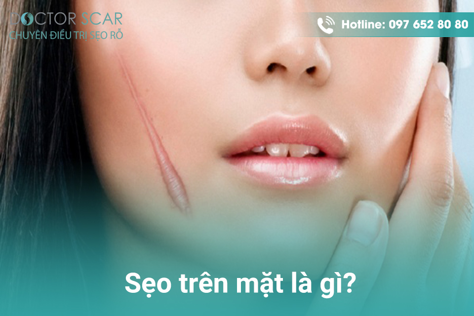 Sẹo trên mặt là gì?