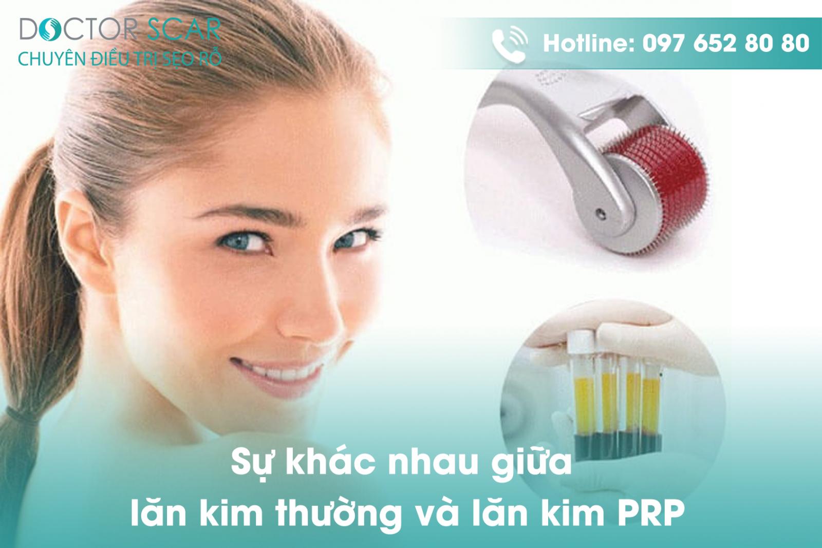 Sự khác nhau giữa lăn kim thường và lăn kim prp