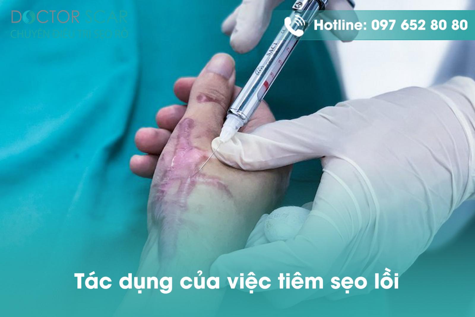 Tác dụng của việc tiêm sẹo lồi