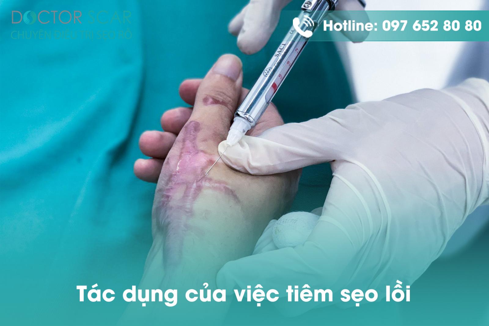 Tác dụng của việc tiêm sẹo lồi