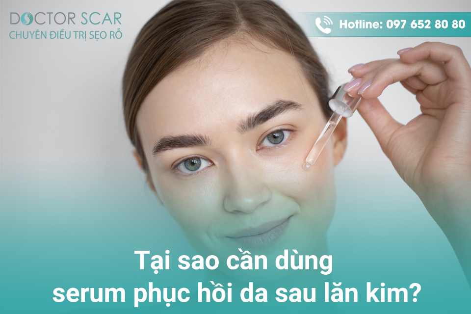 Serum phục hồi da sau lăn kim.