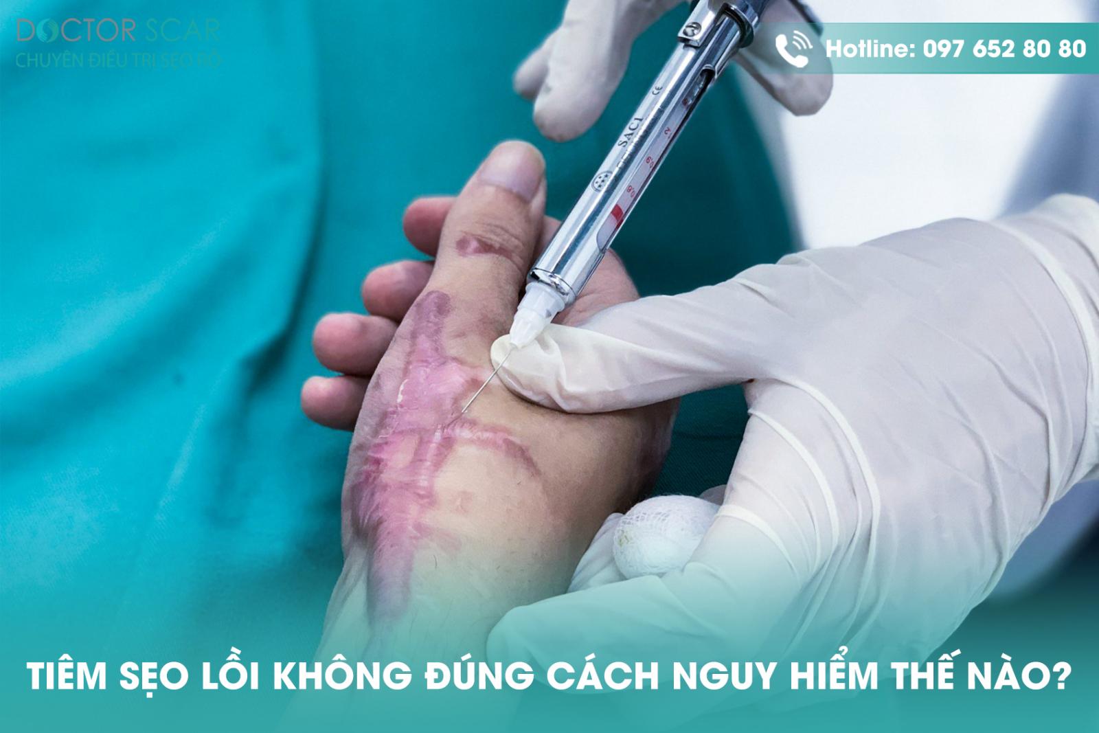 Tiêm sẹo lồi không đúng cách nguy hiểm thế nào?