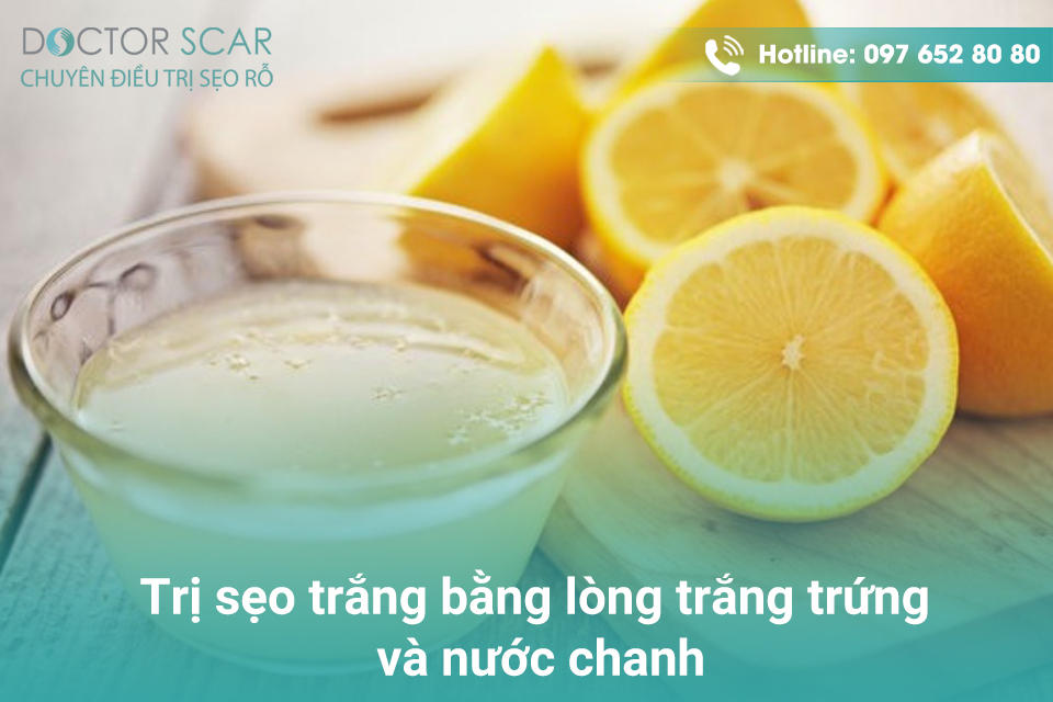 Trị sẹo trắng với lòng trắng trứng và nước chanh