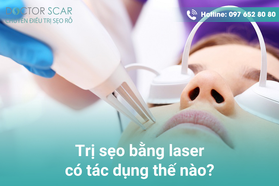 Trị sẹo bằng laser có tác dụng thế nào?