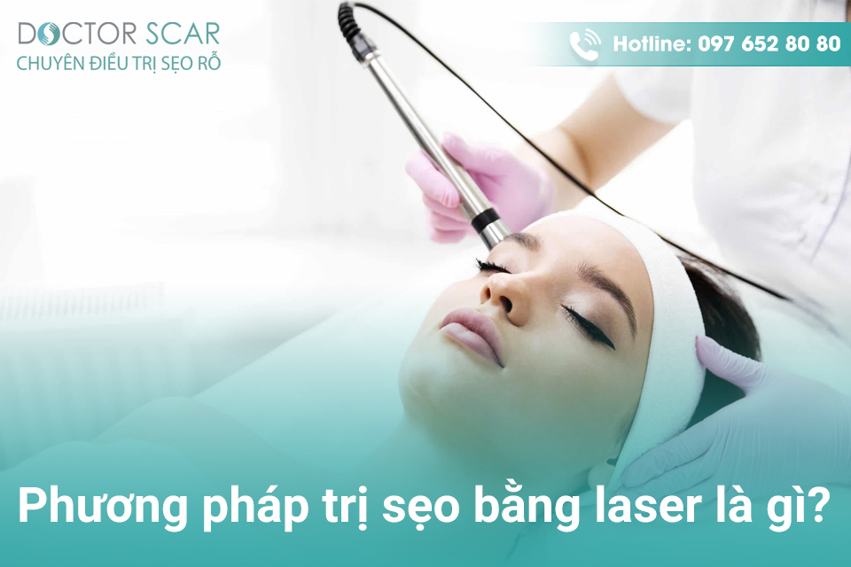 Phương pháp trị sẹo bằng laser là gì?