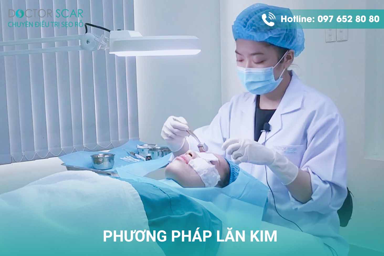 Phương pháp lăn kim