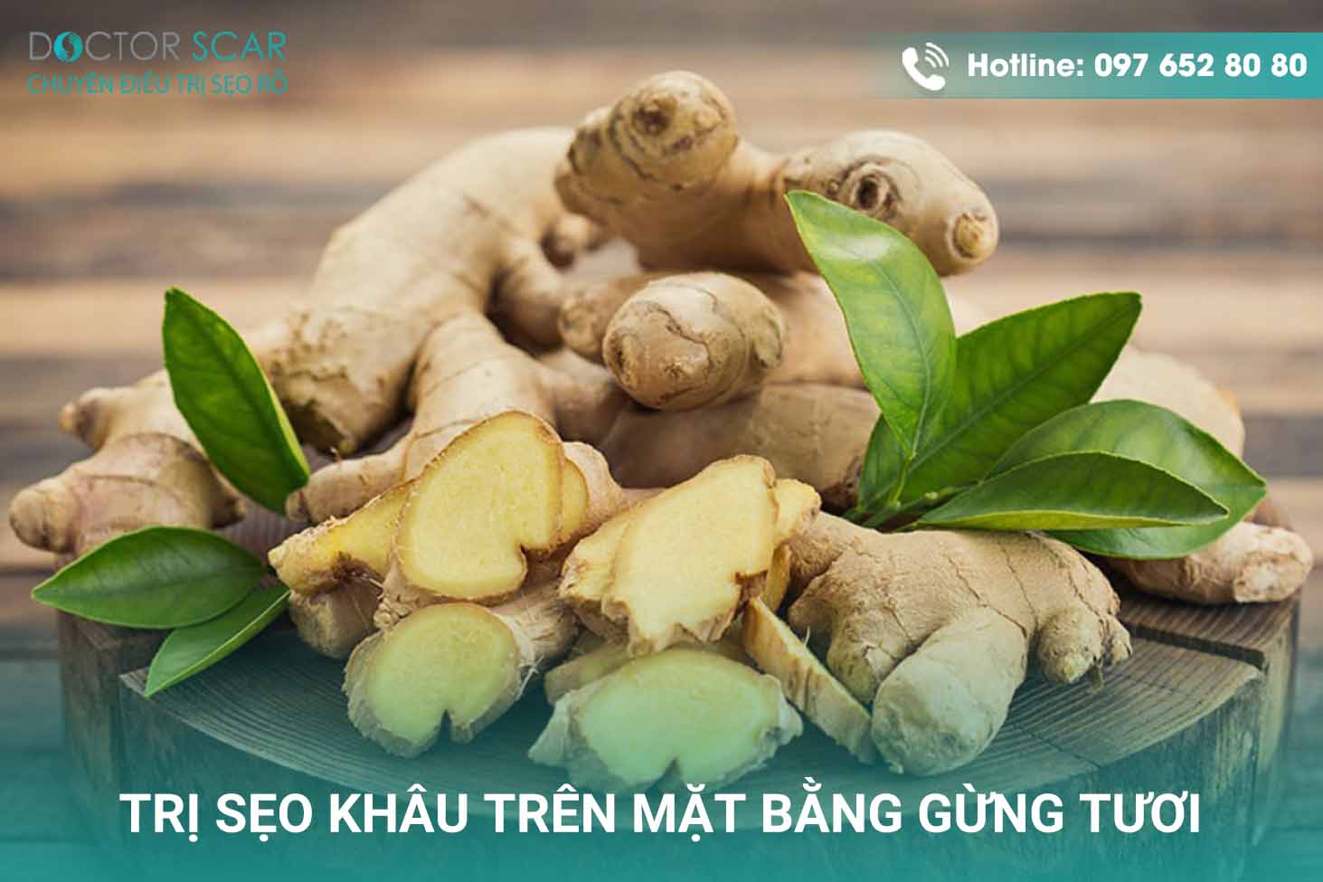 Trị sẹo khâu trên mặt bằng gừng tươi.