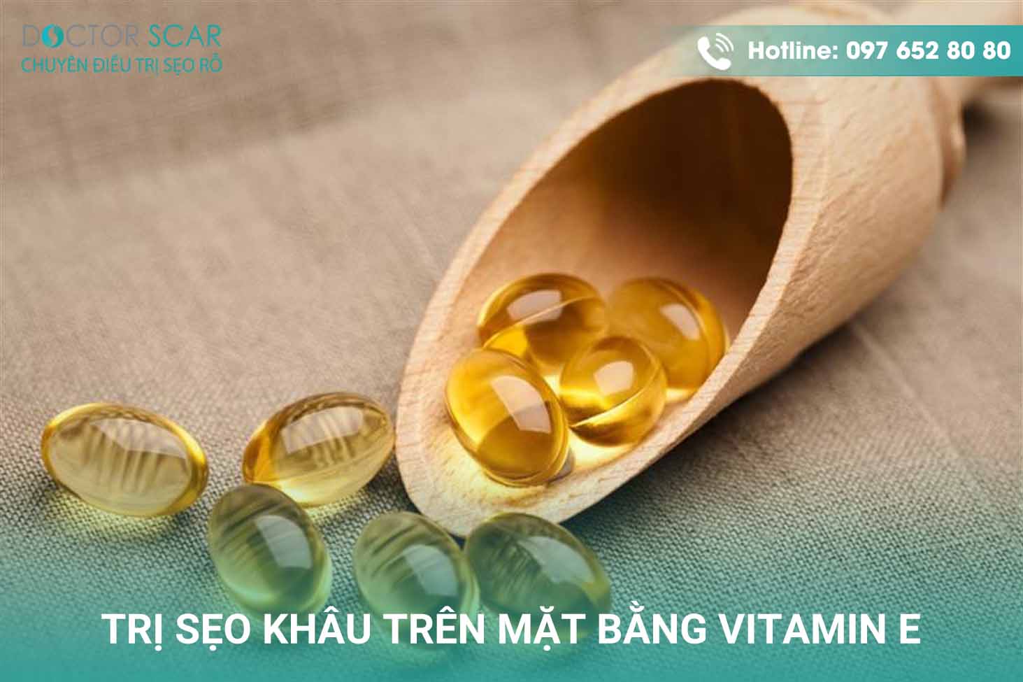 Trị sẹo khâu trên mặt bằng vitamin E.