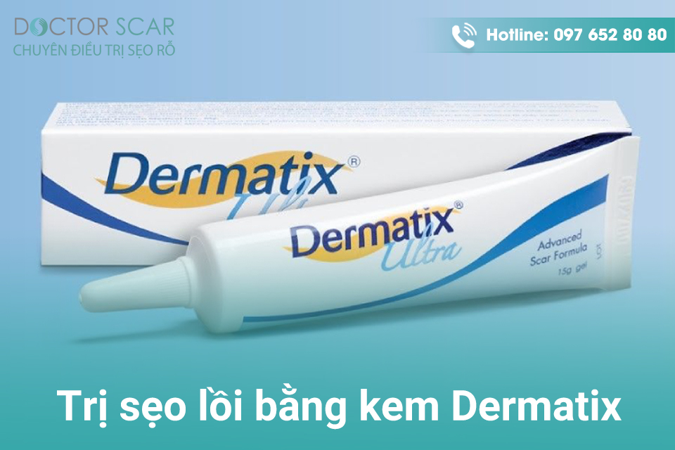 Trị sẹo lồi bằng kem dermatix ultra.