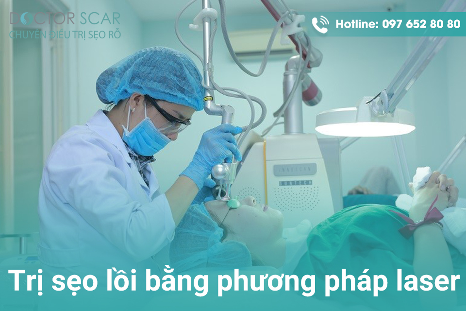 Trị sẹo lồi bằng phương pháp laser