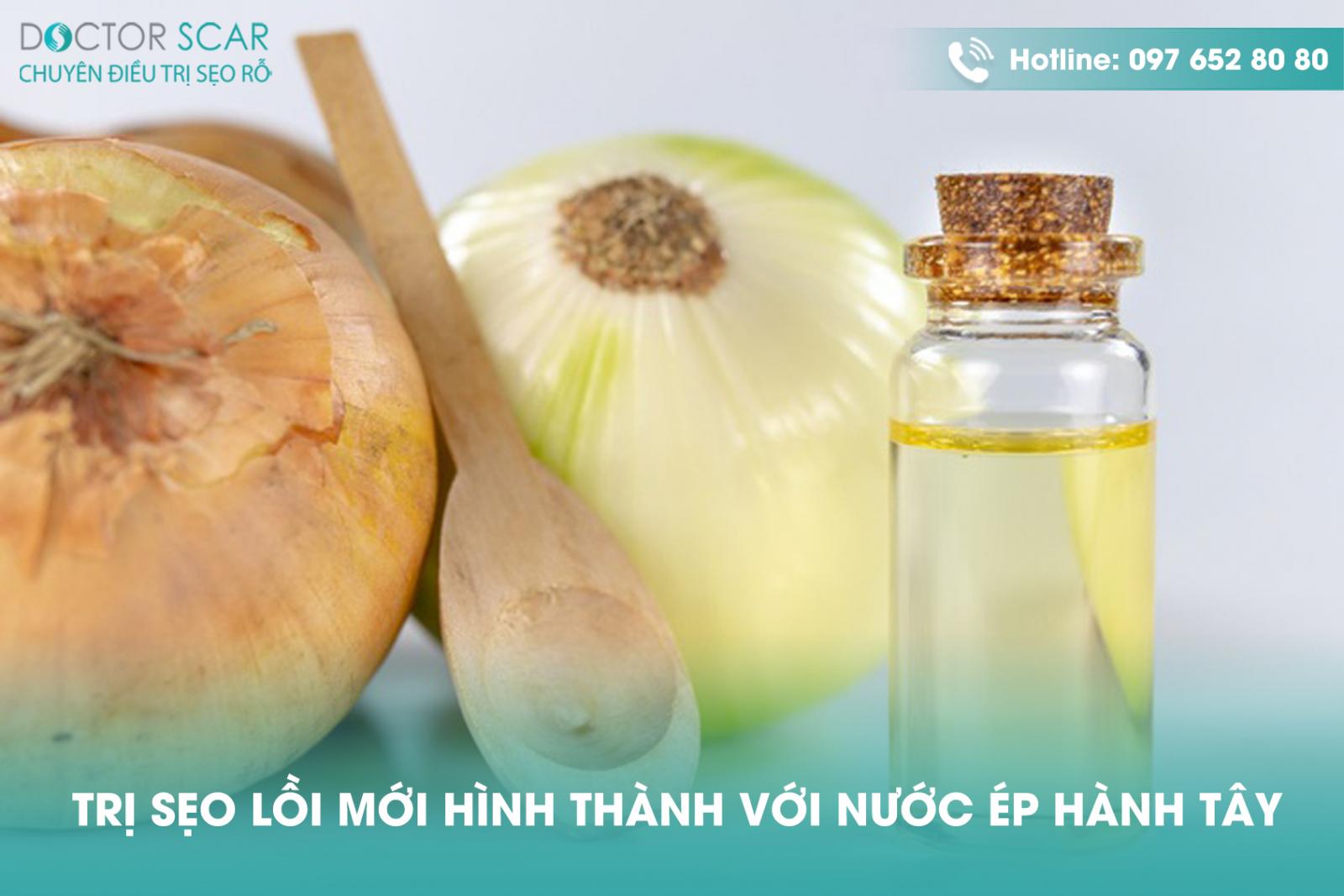 Trị sẹo lồi mới hình thành với nước ép hành tây