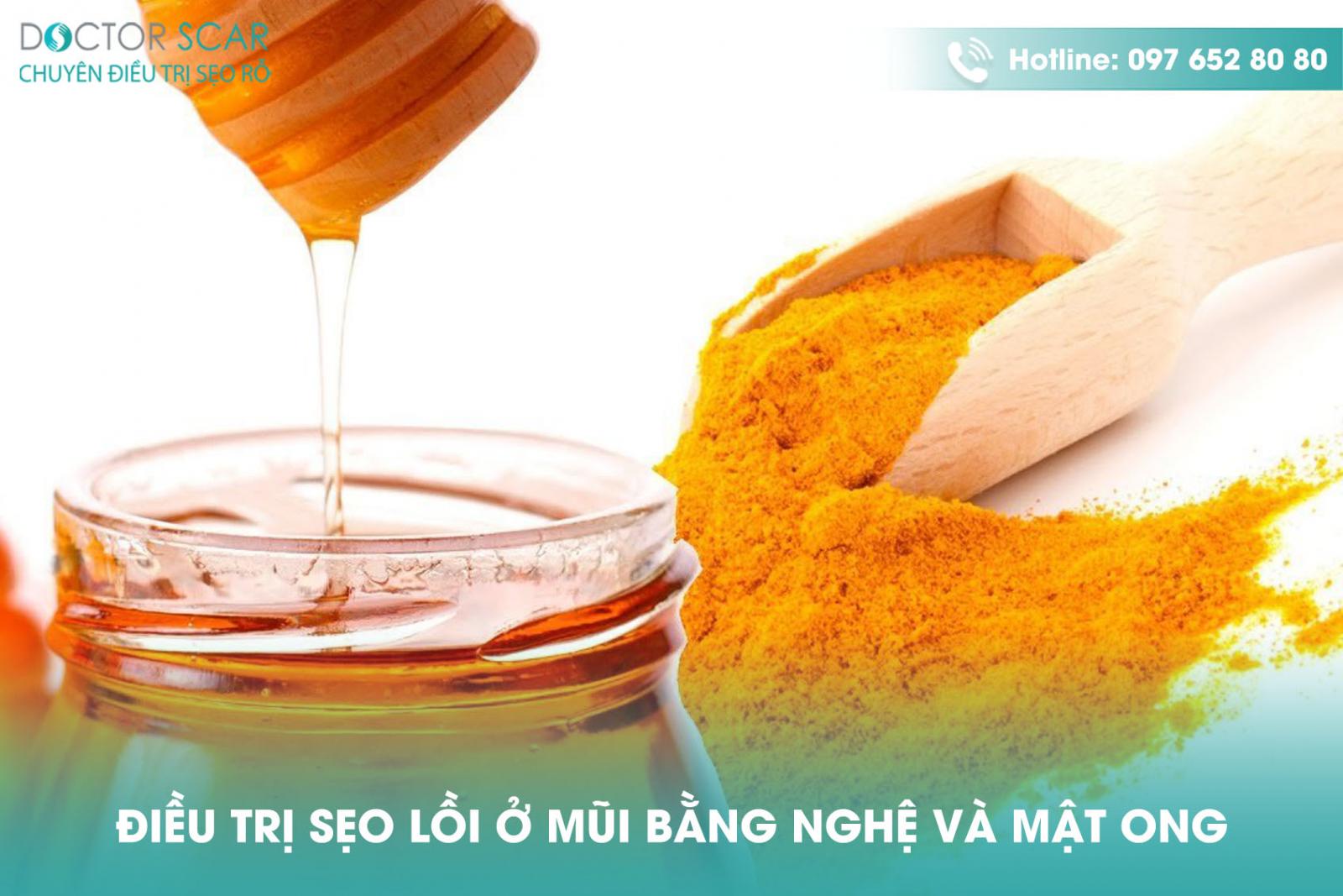 Trị sẹo lồi ở mũi bằng nghệ và mật ong