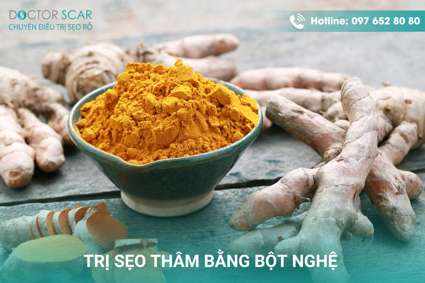 Trị sẹo thâm bằng bột nghệ.