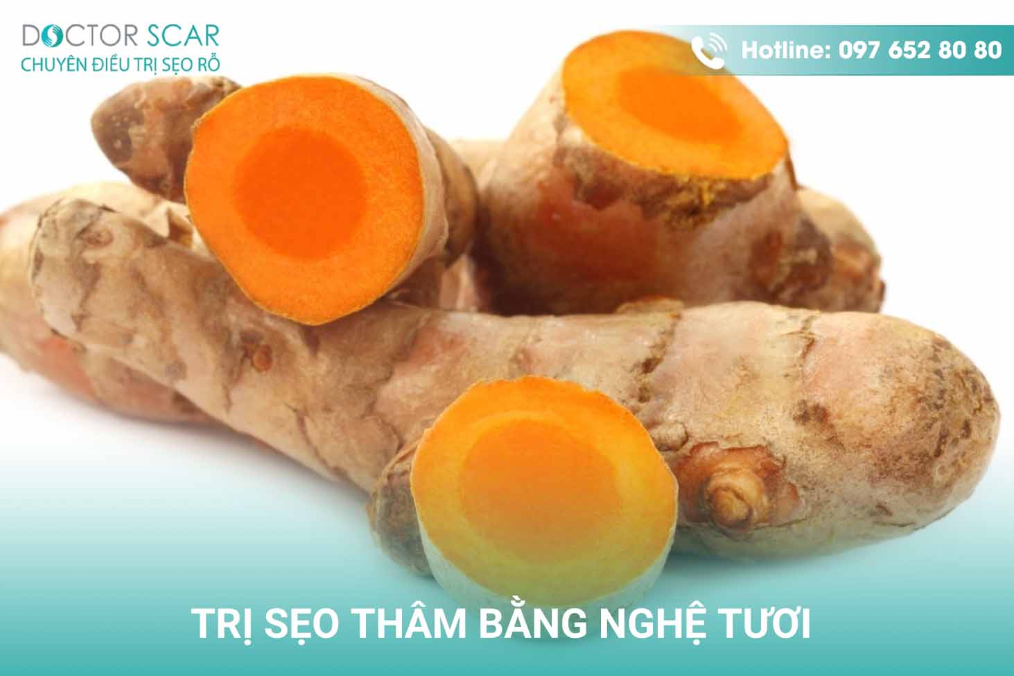 Trị sẹo thâm bằng nghệ tươi.