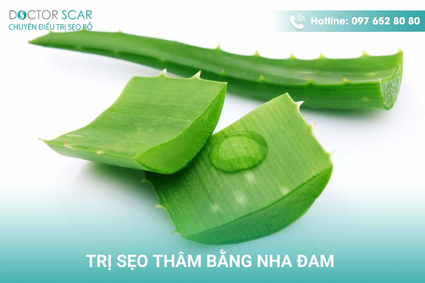 Trị sẹo thâm bằng nha đam.