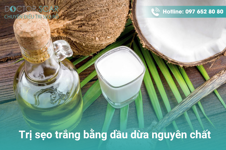 Trị sẹo trắng bằng dầu dừa nguyên chất.