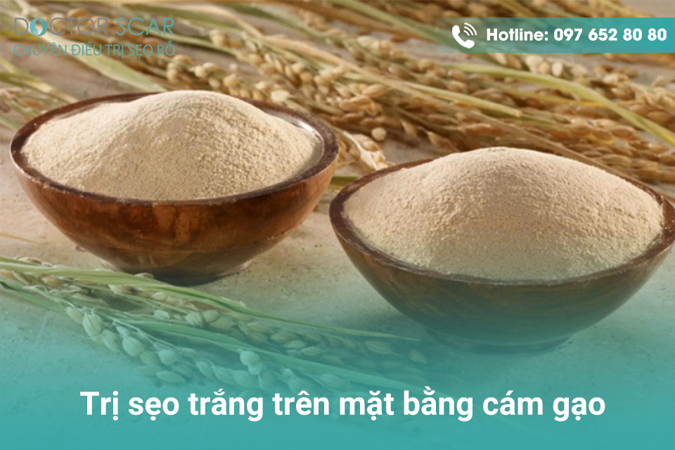 Trị sẹo trắng trên mặt bằng cám gạo.